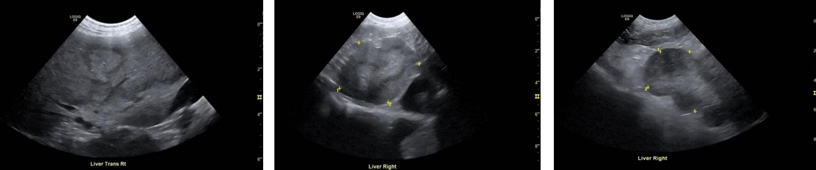 Figure 1: Three ultrasonographic views of the liver