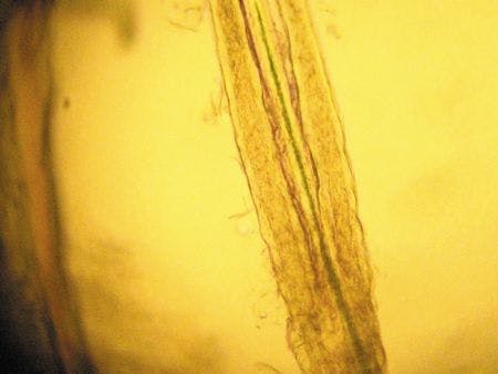 Photo-5-Dermatophyte-on-trichogram.jpg