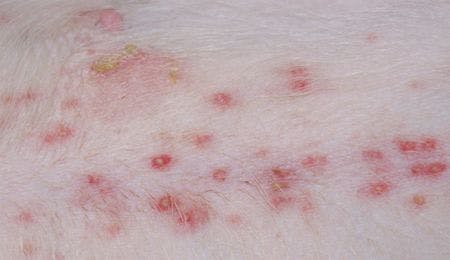 Got a pyoderma? Step away from the systemics