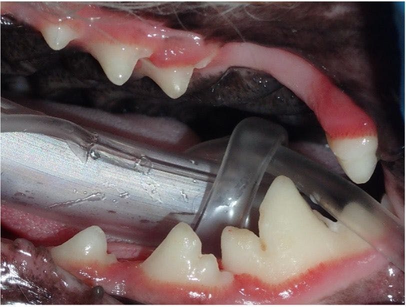 Figure 5: Crowded premolars