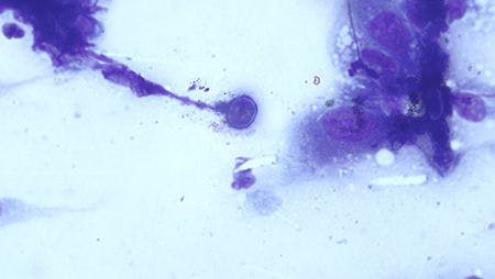 cytology image