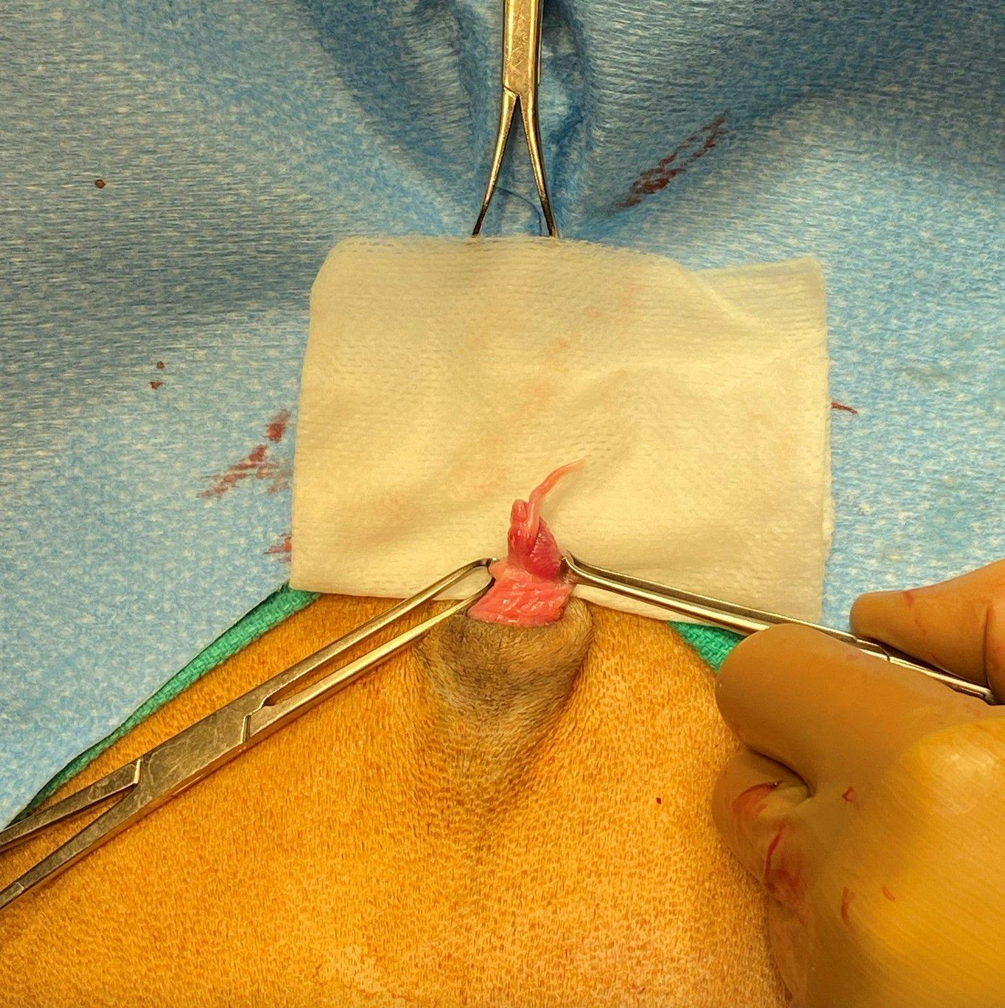 Figure 1. Penis exteriorized for excision of the vermiform appendage.
