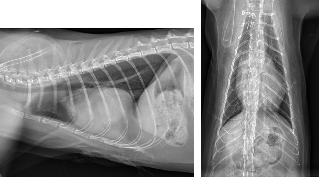 Figure 1: Lateral and ventrodorsal radiographs of a cat with a peritoneal pericardial diaphragmatic hernia (PPDH). Notice the irregularity of the cardiac silhouette as well as the variable density within the pericardial shadow consistent with omental and hepatic herniation.(All images courtesy of Miller)