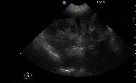 Liver-DVM-Ultrasound_450.jpg