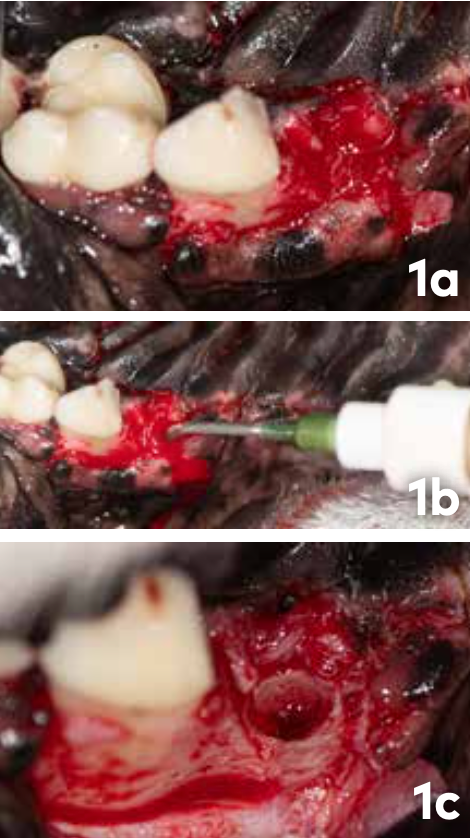 HACK 1: Fig. 1a Excessive bleeding from mesial and palatal roots of the left maxillary fourth premolar, 1b Application of VETIGEL to the extraction sites, 1c- within seconds bleeding blocked.