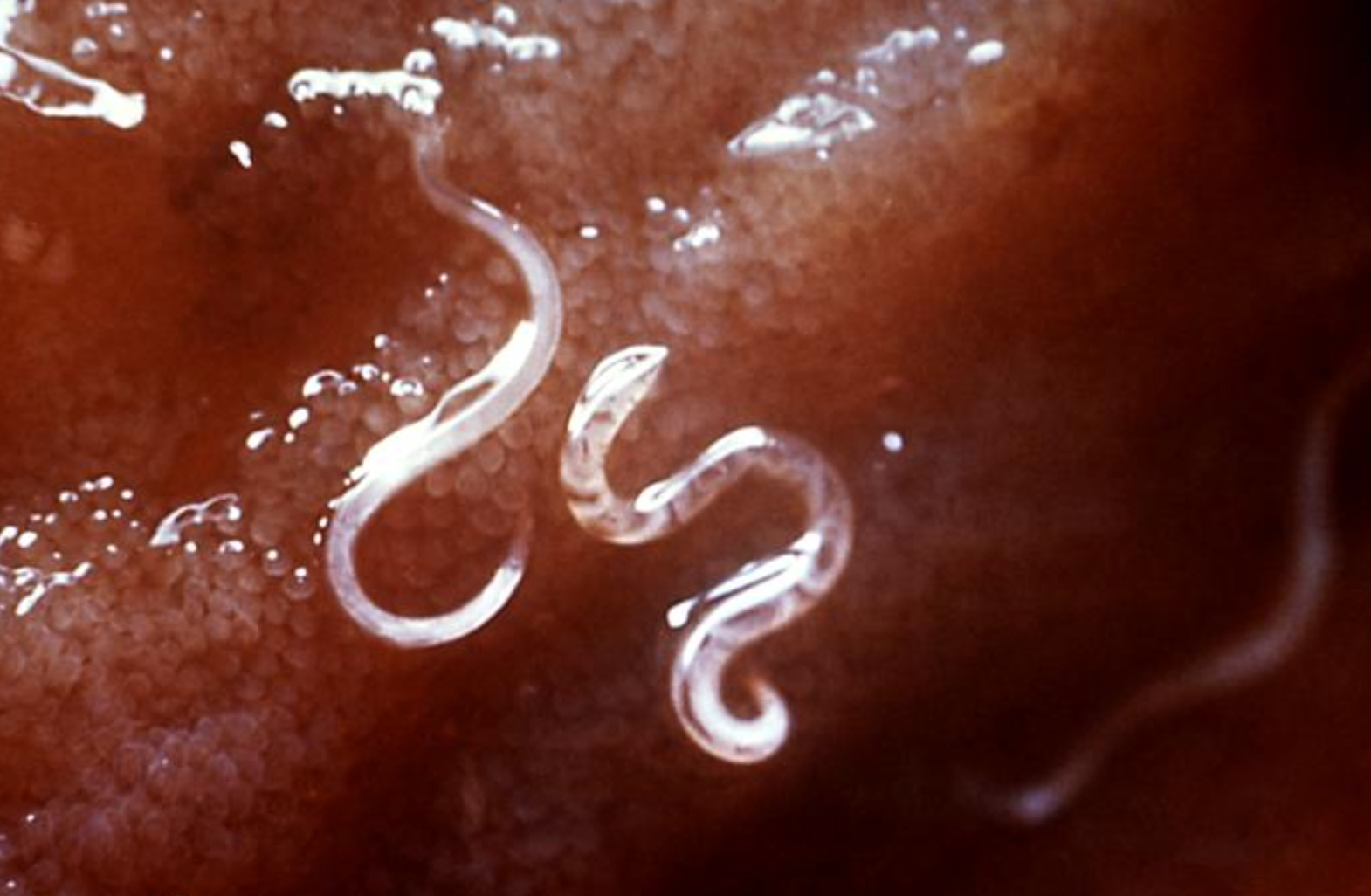 Image of A. caninum courtesy of the CDC