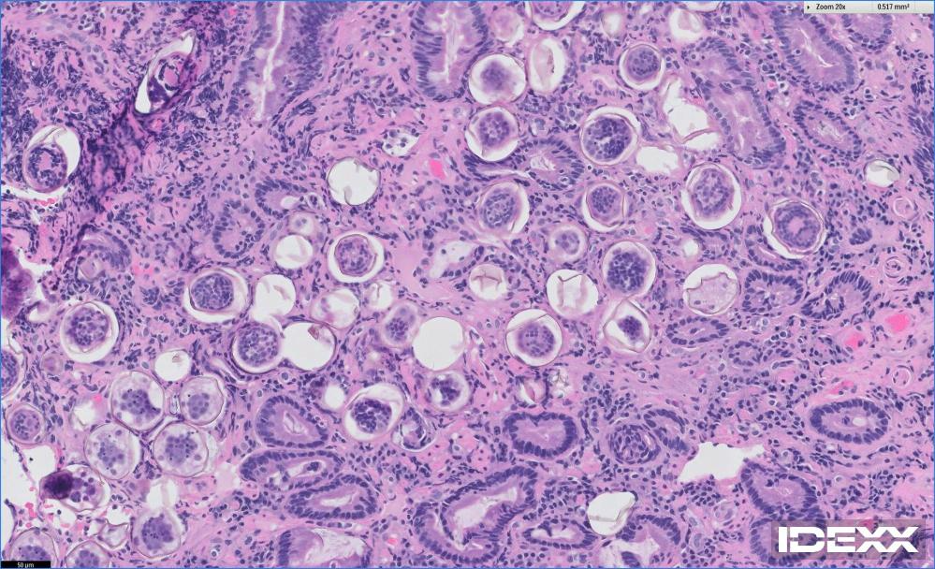 Figure 4. Heterobilharzia americana eggs in the intestinal tract of a 6-year-old female spayed Labrador retriever with chronic diarrhea and hyperglobulinemia. (Image from endoscopic biopsies performed by Idexx Laboratories)