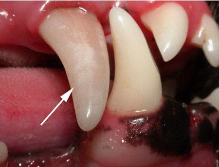Discolored-(non-vital)-right-maxillary-canine-tooth_450.jpg
