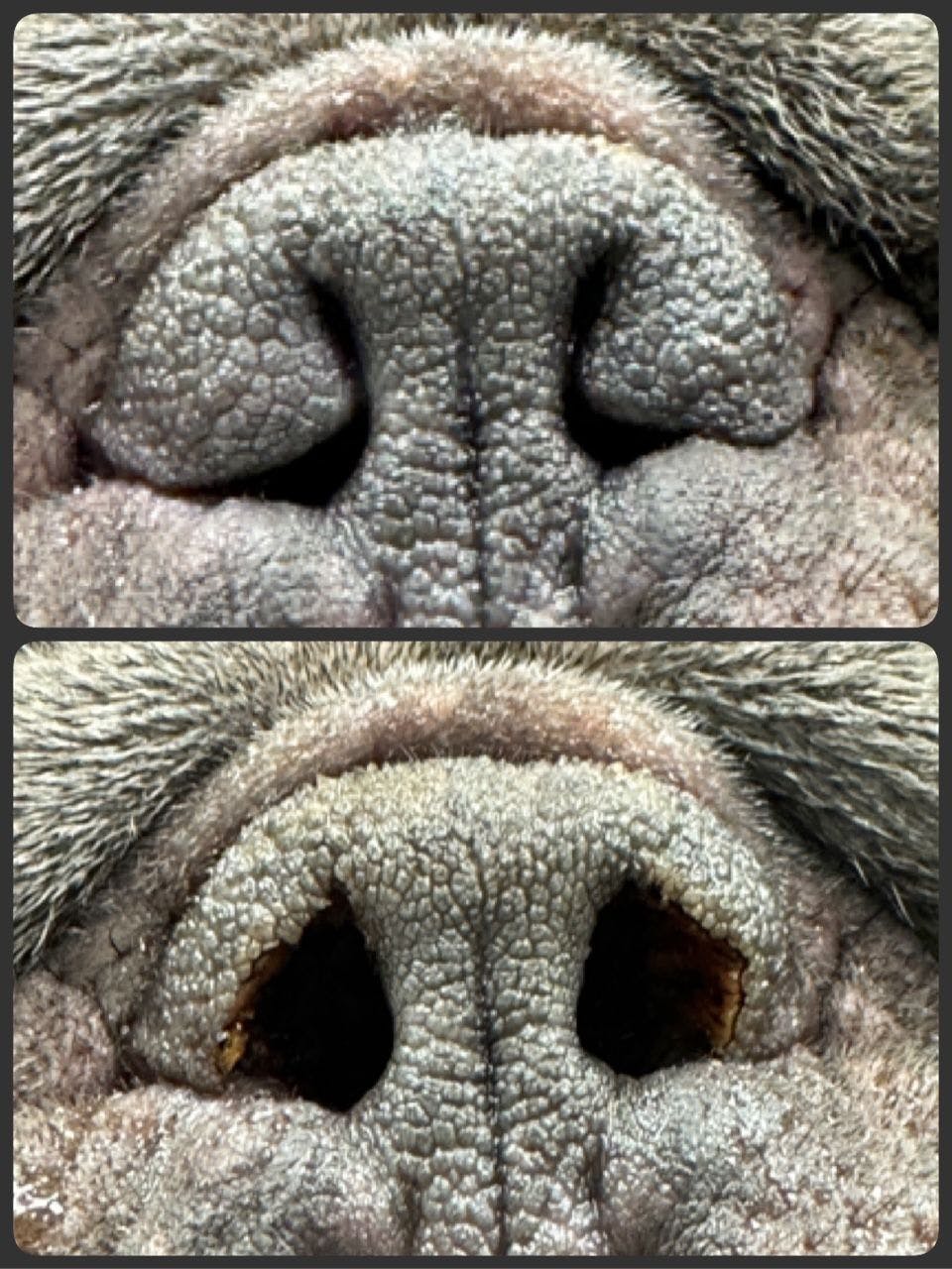 The patient is shown before (top) and after laser rhinoplasty (bottom).