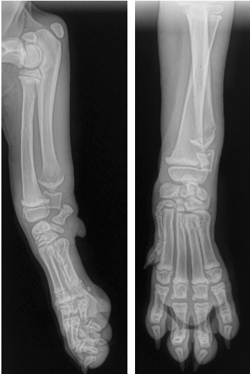Figure 3 (A and B). Orthogonal radiographic views of the antebrachium of a 2.5-month-old Labrador puppy diagnosed with hypertrophic osteodystrophy. The typical “double physeal line,” a radiolucent line in metaphysis parallel to a narrow zone of increased radiodensity immediately adjacent to the physis, can be seen in association with the distal radial and ulnar physes. (Radiograph courtesy of Fernando A. Castro, DVM, DACVR, DACVS-LA)