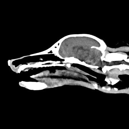 Saggital view of CT scan
