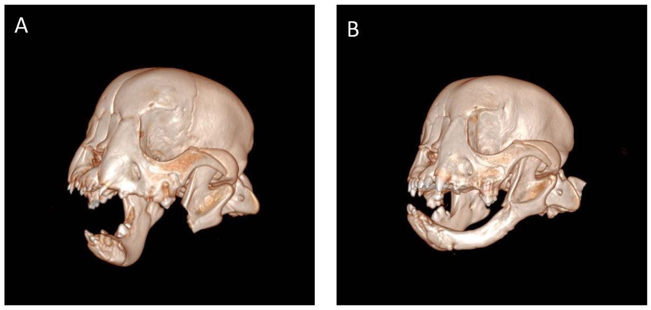 3D scans of Tyson show his removed jaw immediately after surgery (left) and 8 weeks afterwards (right) with the mandible regrown.
