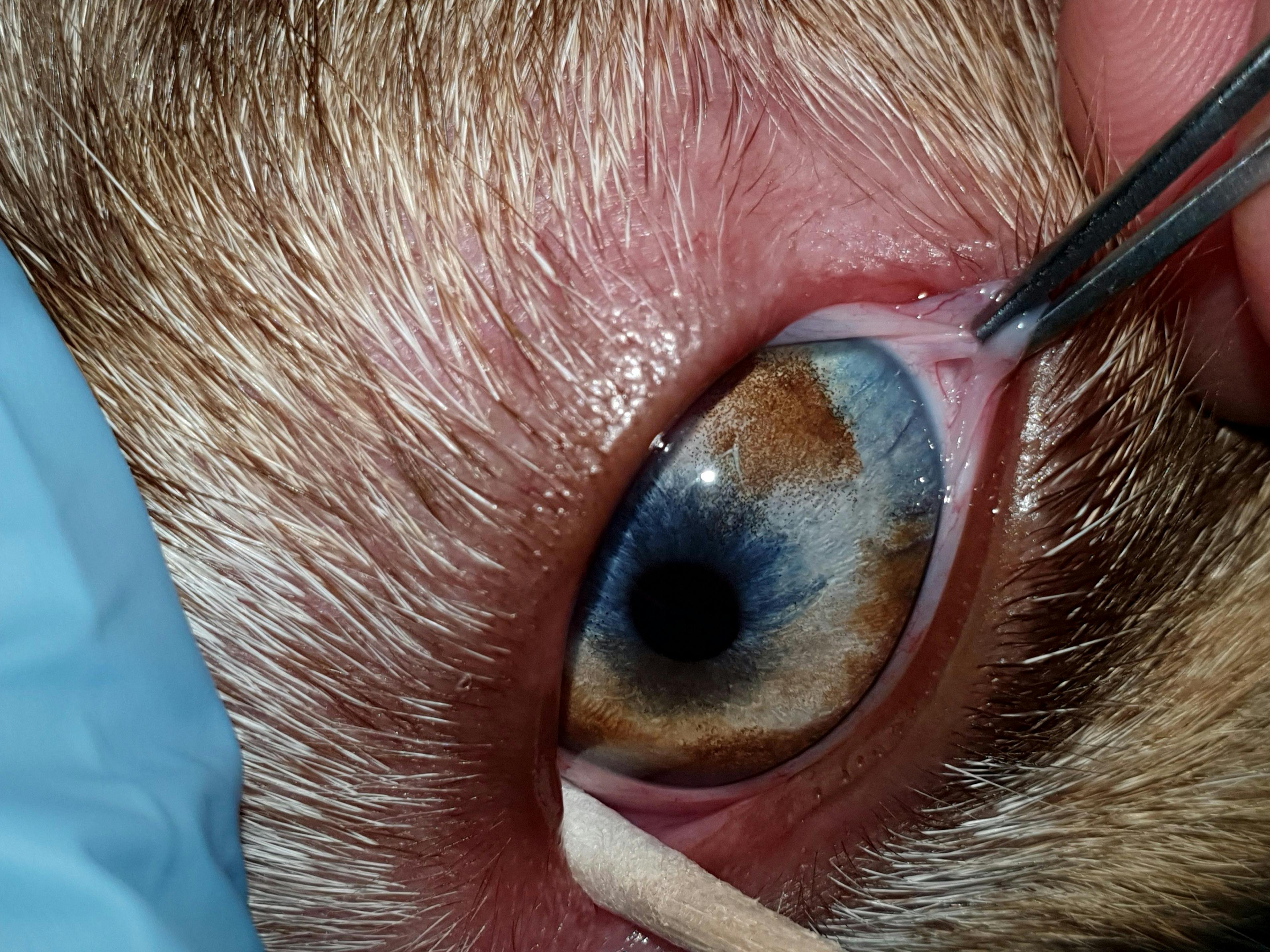 Figure 8. Heterochromia iridis, or a multicolored iris. This case is a normal congenital variation, but in some patients, changes in iris color may indicate inflammation or neoplasia.