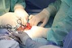 Intraoperative Complications in Student-Performed Laparoscopic Ovariectomy