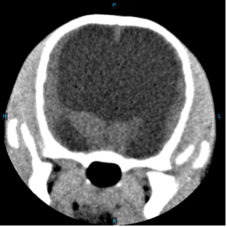 Figure 3.Severe congenital hydrocephalus in a juvenile Chihuahua with a history of seizures. Although MRI is often used for brain disease, this CT accurately depicts the degree of ventricular dilation.