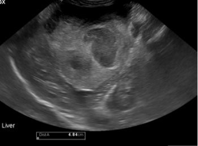 Figure 2: Ultrasound images of hypoechoic liver masses identified on dog diagnosed with anaphylactic reaction.