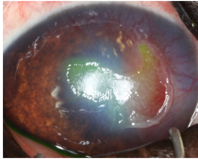Image Quiz: Can you name these ophthalmic conditions? (sponsored by Nationwide)